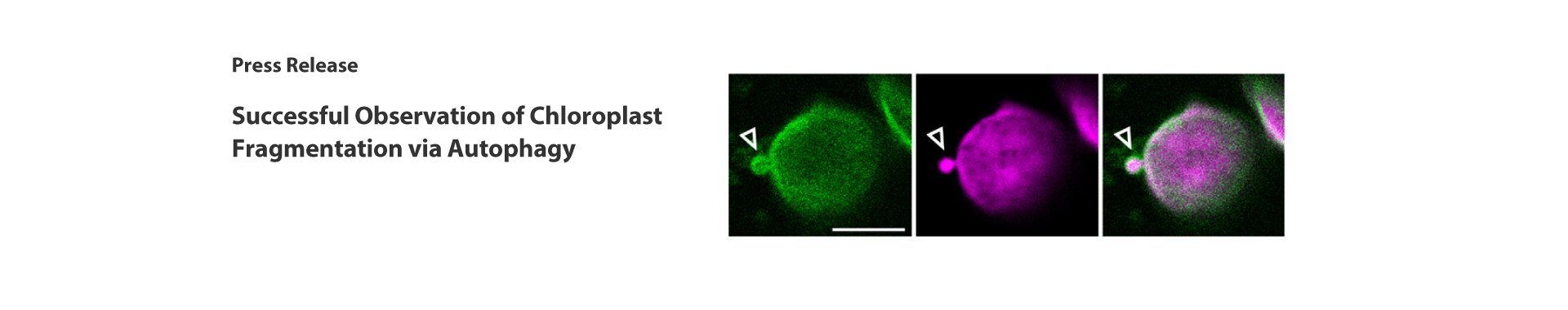 Successful Observation of Chloroplast Fragmentation via Autophagy