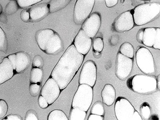 自然に生分解されるバイオプラスチック