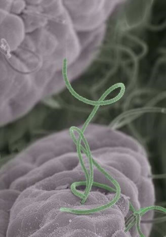 走査電子顕微鏡で捉えたマウス腸内のセグメント細菌